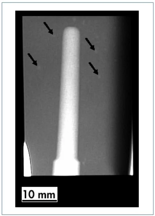 Fig. 3: Radiographic image of the bulkhead support
showing the presence of porosity
