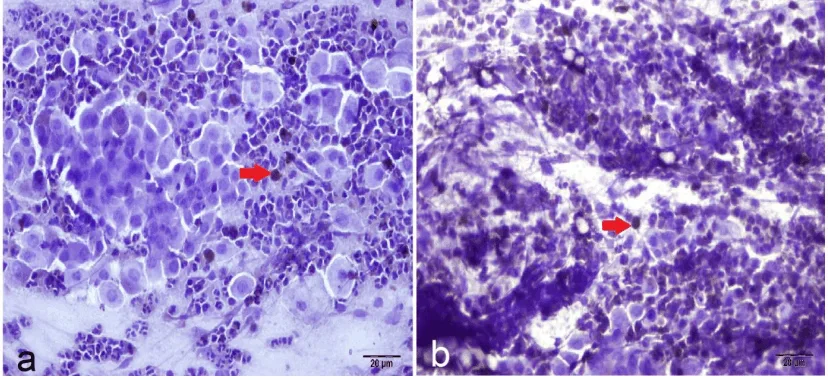 Figure 1:The image of epithelial cells recovered from the endometrium via cytobrush.