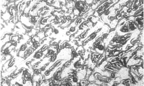 Fig. 2. Micrograph of Al-8%Si Alloy Sand Cast at a Pouring Temperature of 700o C (x125); white patches are primary α while dark patches are eutectic, α + Si.