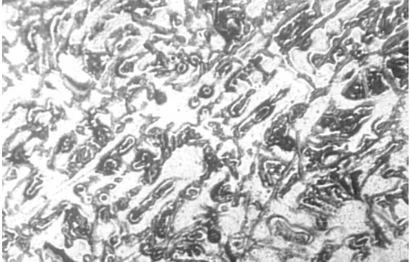 Fig. 2. Micrograph of Al-8%Si Alloy Sand Cast at a Pouring Temperature of 700o C (x125); white patches are primary α while dark patches are eutectic, α + Si.