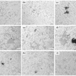 Fig. 4 Microstructure of hub, spokes, and rim parts after T6-treated; (a)-(c) are from H1, H4, and H7, respectively; (d)-(f) are from S1, S4, and S7, respectively; (g)-(i) are from R1, R4, and R7, respectively