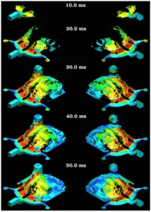 Fig. 1. Filling of differential cover with the molten metal coloured by speed with blue being slow and red being fast. The casting is shown in top view on the left and bottom view on the right. (For interpretation of the references to colour in this figure legend, the reader is referred to the web version of this article.)