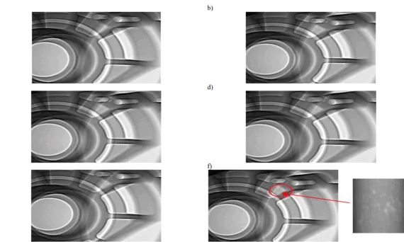 Fig. 2. Exemplary results of the X-ray inspections for the details of various circulating scrap proportions: a) sample No. 1, b) sample No. 2, c) sample No. 3, d) sample No. 4, e) sample No. 5, f) sample No. 6