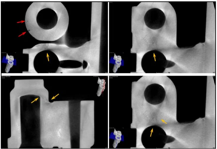 Fig. 6. Detection of two spherical porosity on the edges with
sponge type porosity on the second section